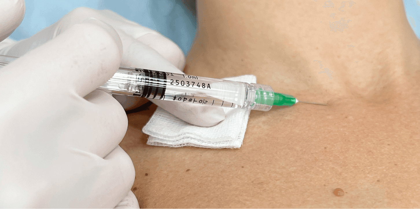 омоложение plinest калининград