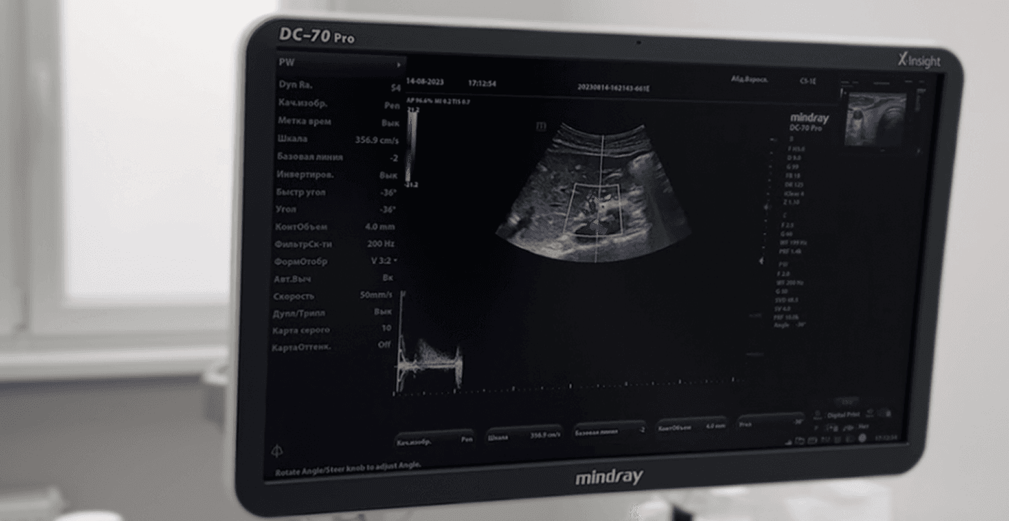 узи бршной полости в калининграде в клинике Idmed