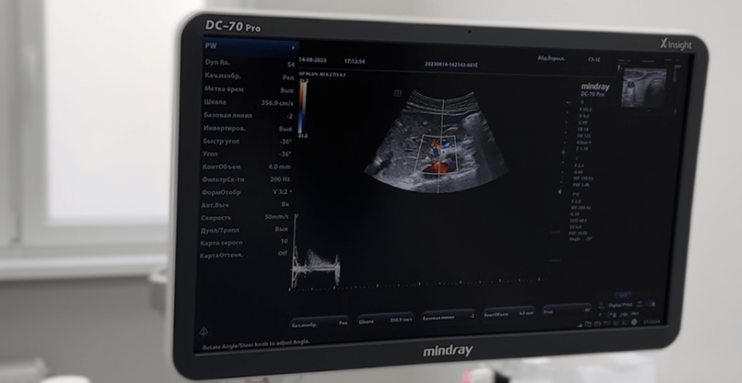 узи бршной полости в калининграде в клинике Idmed